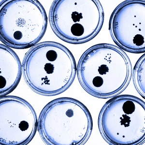 petri_dishes_large_number_samples