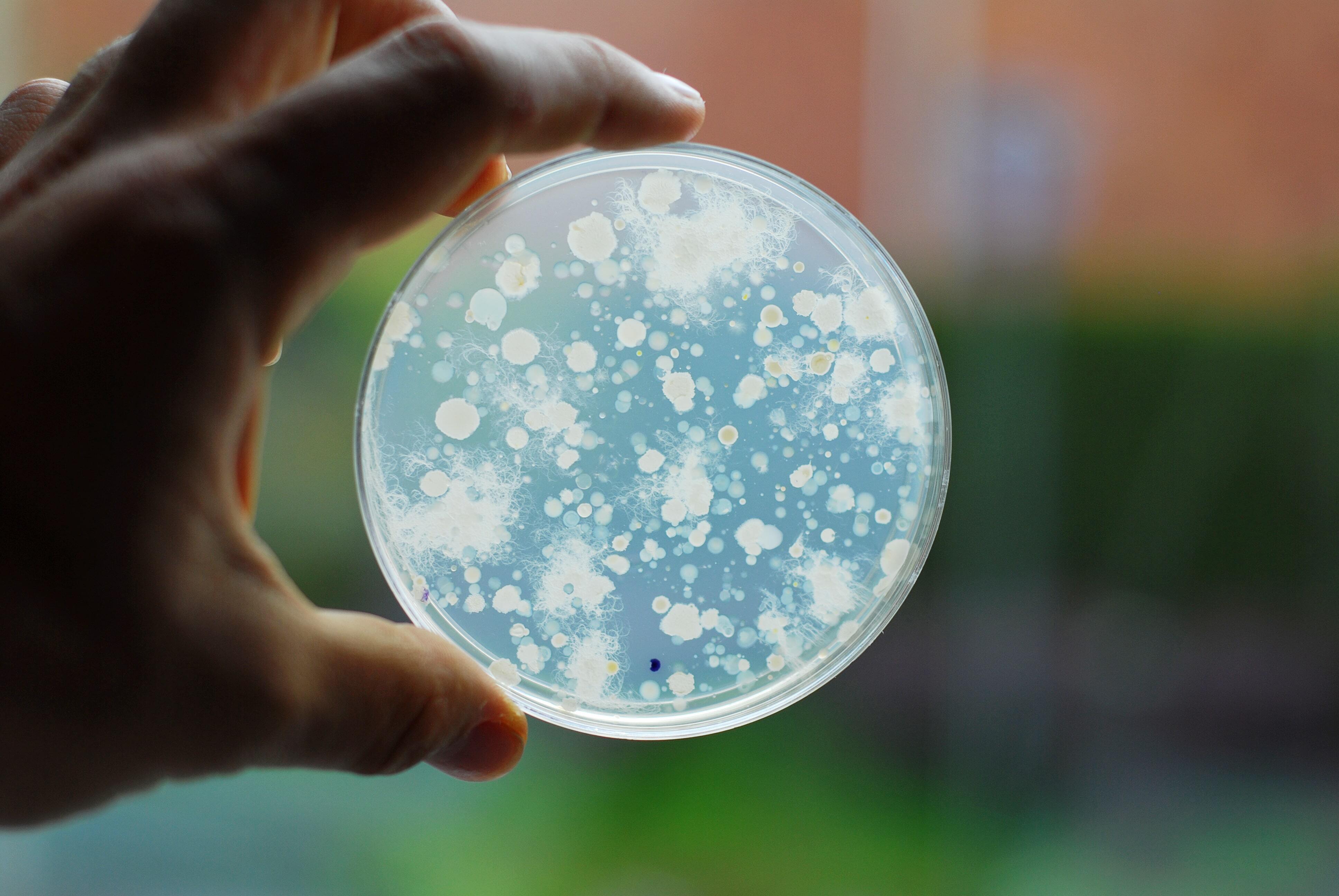 Bacteria-growing-147708380_3872x2592-min