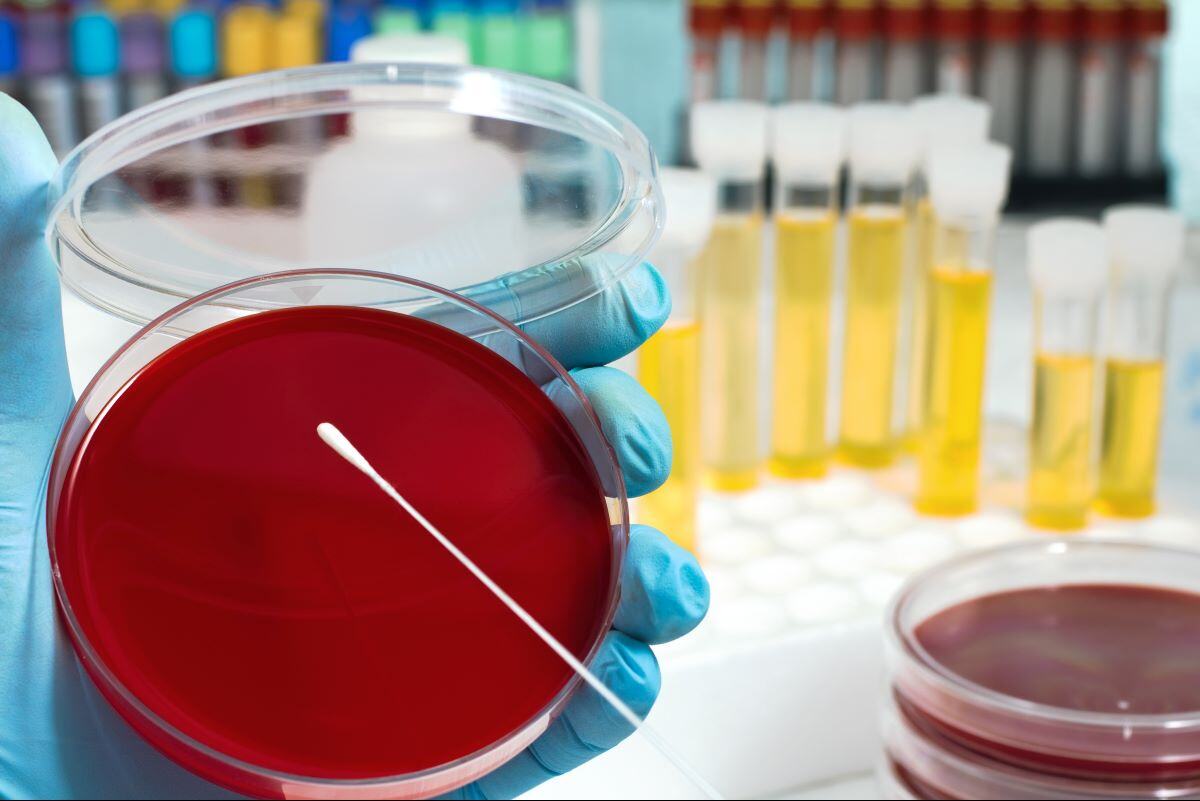 In-house swab microbial recovery study